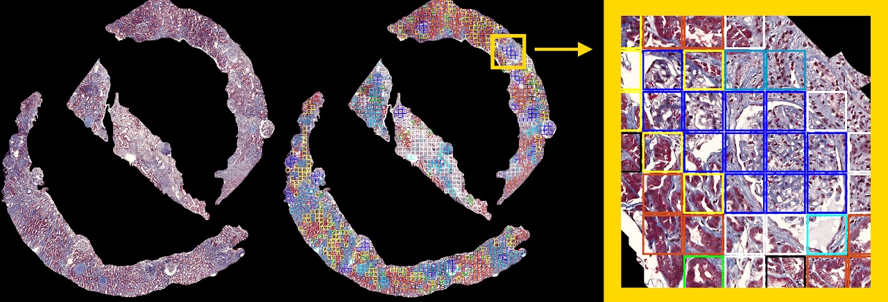 image of healthcare professional using ai software